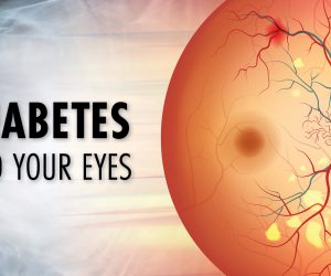 Types of Diabetic Eye Disease