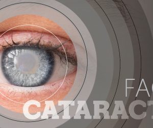 FAQ: Cataracts